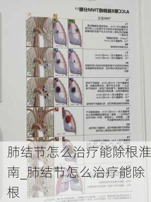 肺结节怎么治疗能除根淮南_肺结节怎么治疗能除根